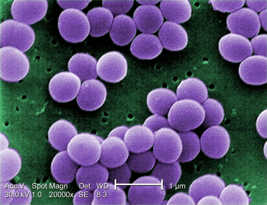 Des scientifiques du MIT utilisent l’IA pour lutter contre les bactéries résistantes aux antibiotiques